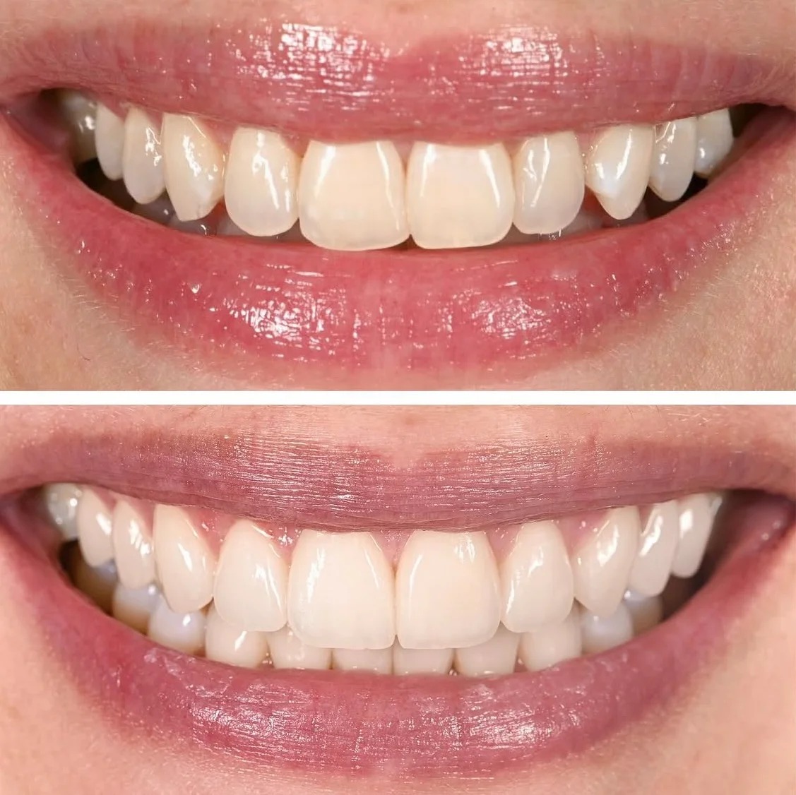 Cosmetic dentistry